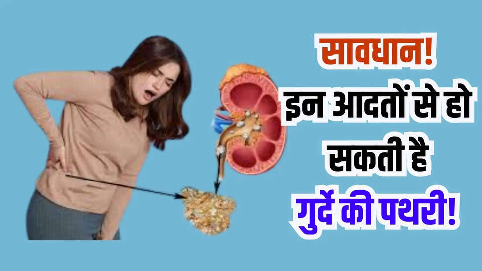 kidney stone