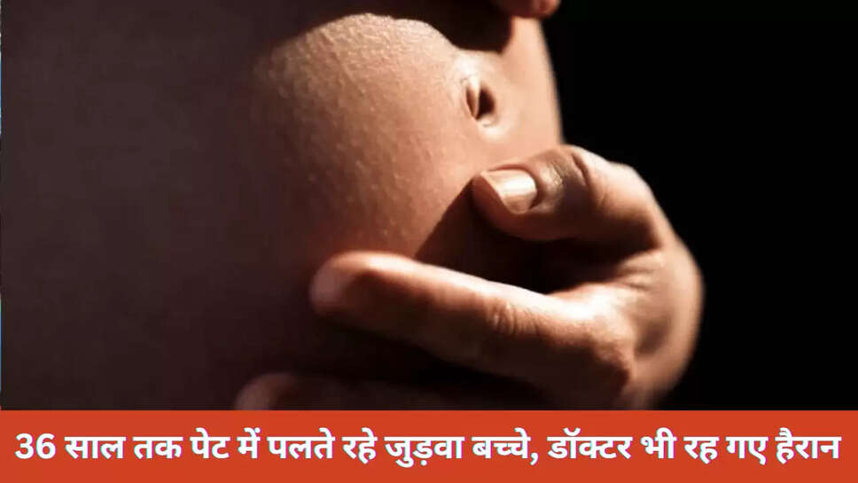 Pregnant Man