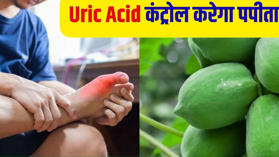 uric acid control